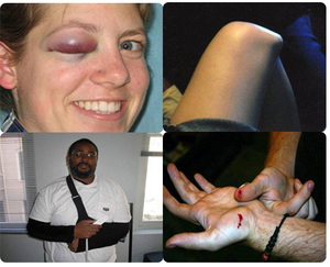 121606wiiinjuries